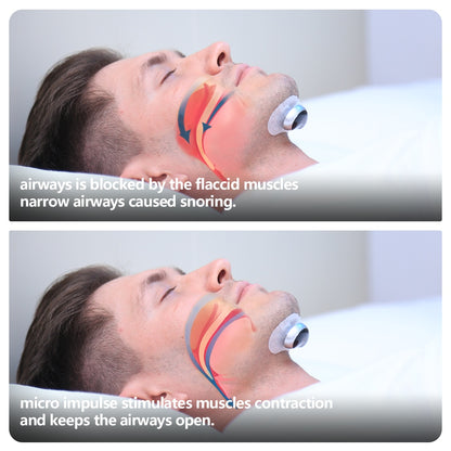 Smart Anti Snoring Device – Electronic Muscle Stimulator